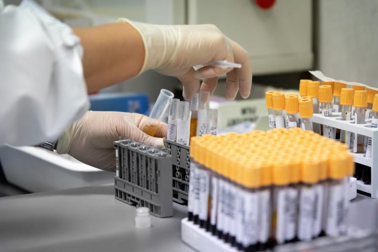 TEST SIEROLOGICI, RAZZA: "RISULTATI UTILI, SICILIANI RISPONDANO ALL'APPELLO"