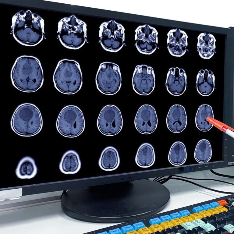 Tumori cerebrali: la neurochirurgia del policlinico di Messina prima in Sicilia come numero di interventi