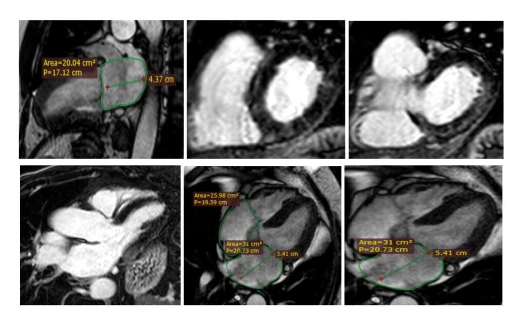 nuova ecografia emodinamica Patti