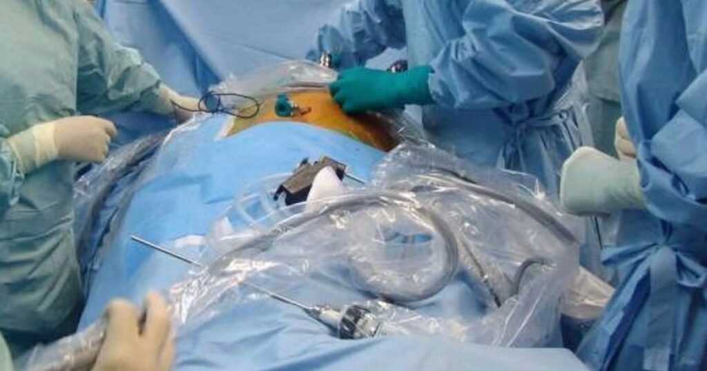 Il buio oltre la sala operatoria: il caso del trapianto negato al Monaldi 3 cuore bruciato dal freddo